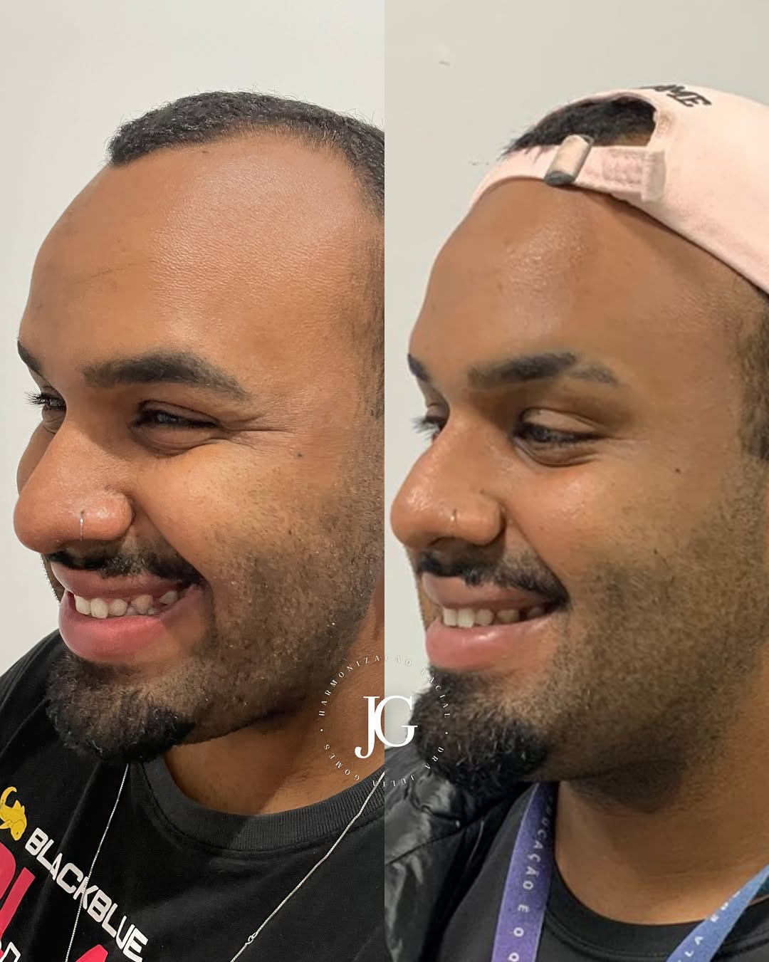 SaveClip.App_561082140_17910214356240654_5251886840050235001_n