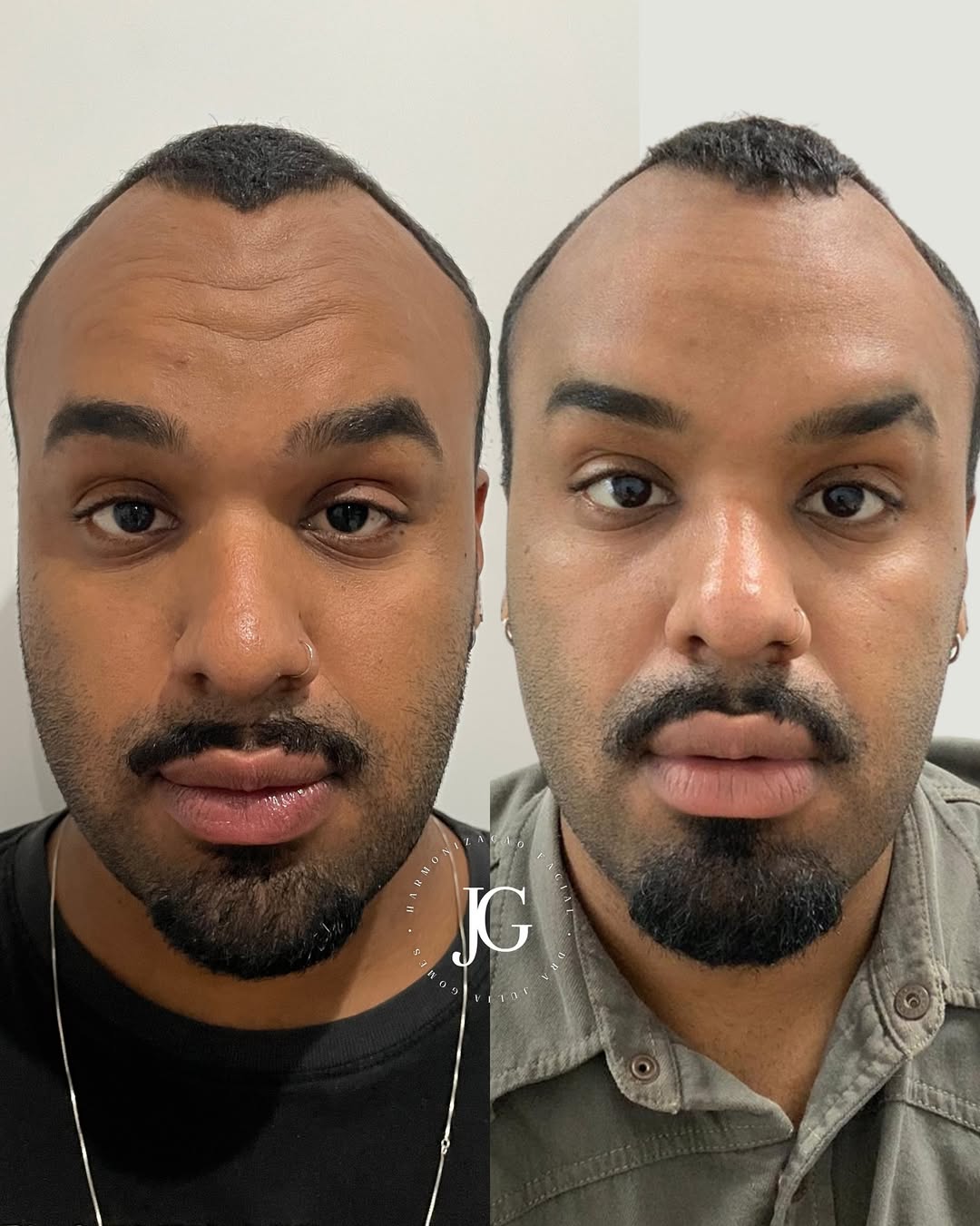 SaveClip.App_561418449_17910214326240654_5682463380412890213_n